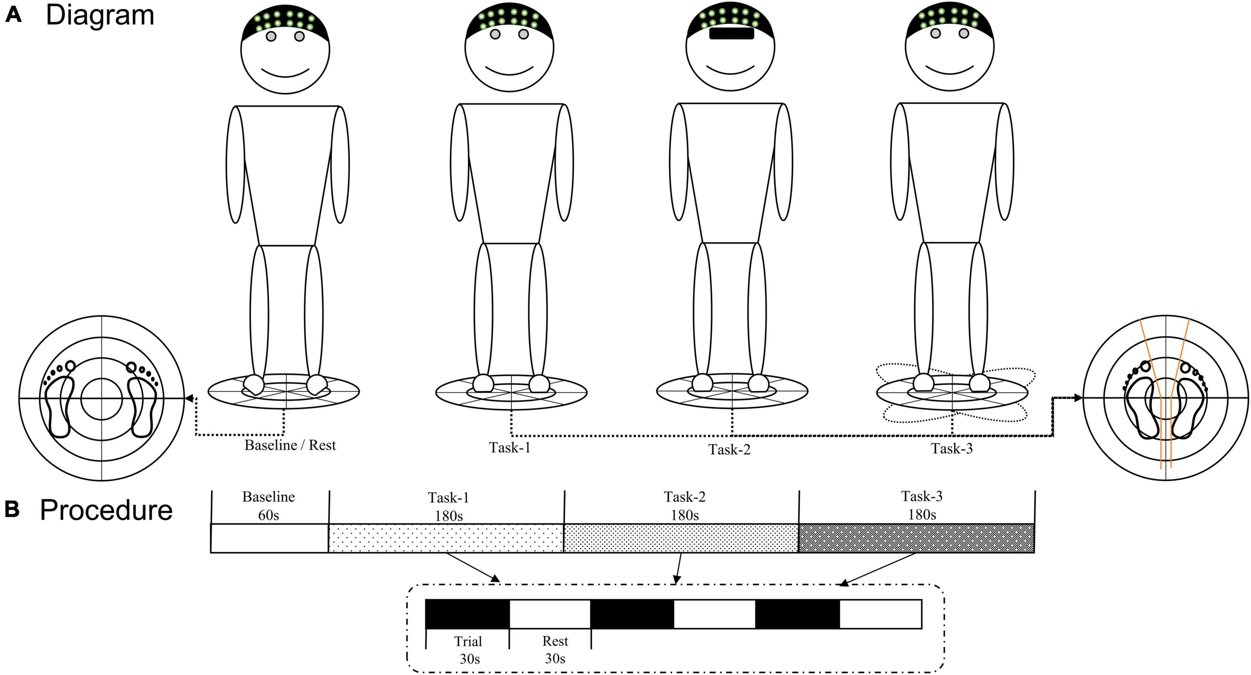 Changes in cortical activation during upright stance in individuals with chronic low back pain: An fNIRS study